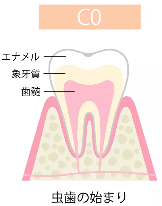 c0の画像