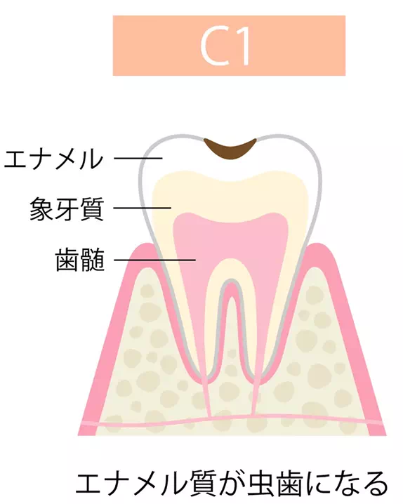 c1の画像