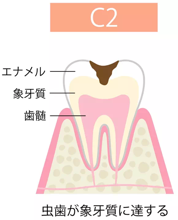 c2の画像