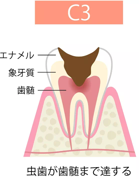 c3の画像
