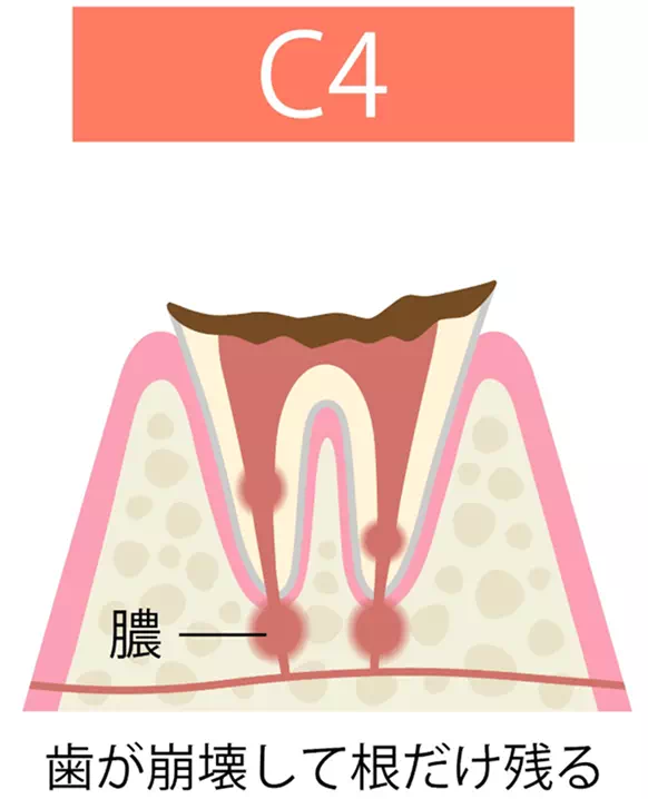 c4の画像