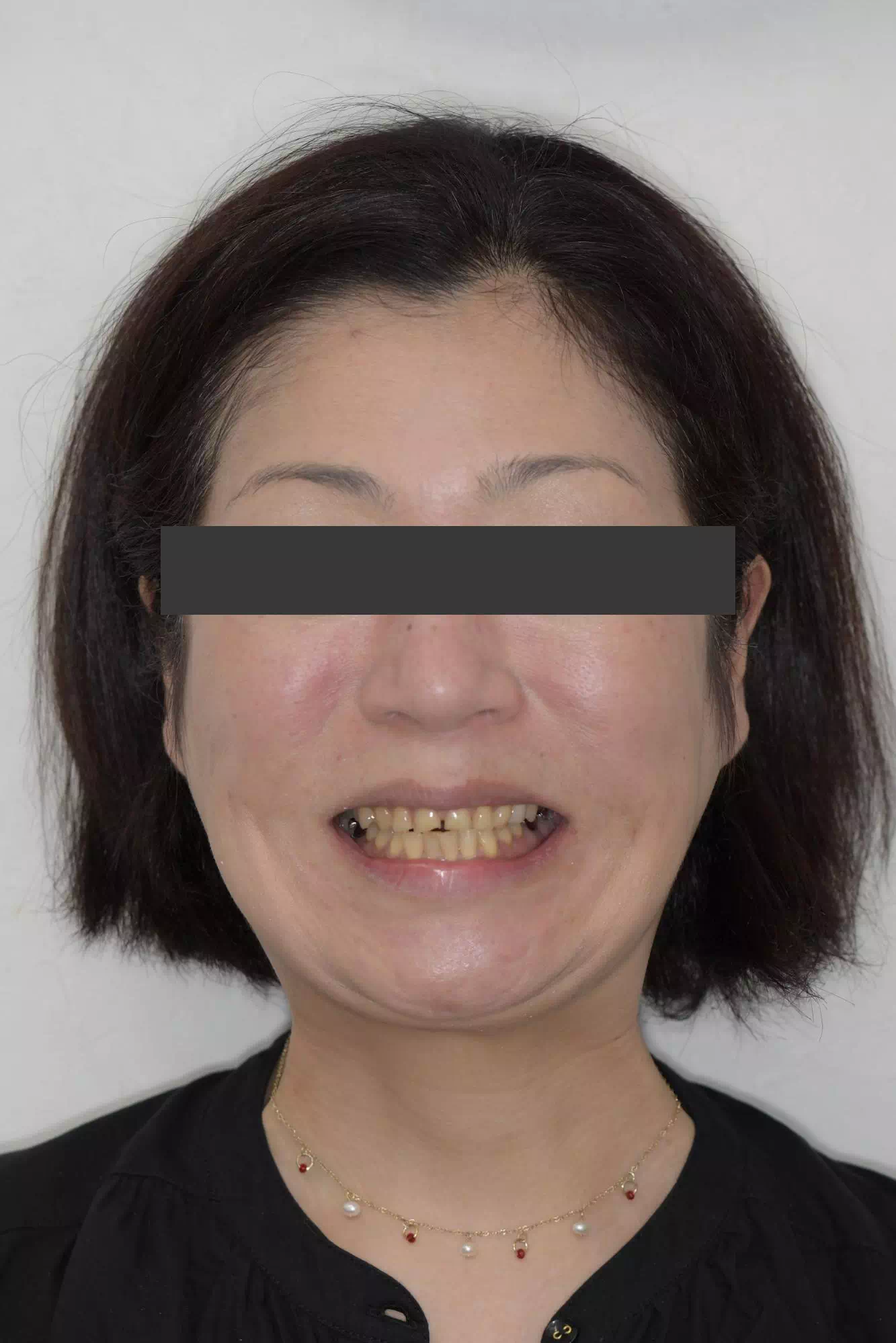 術前の画像
