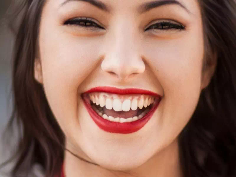 ガミースマイルの女性の画像