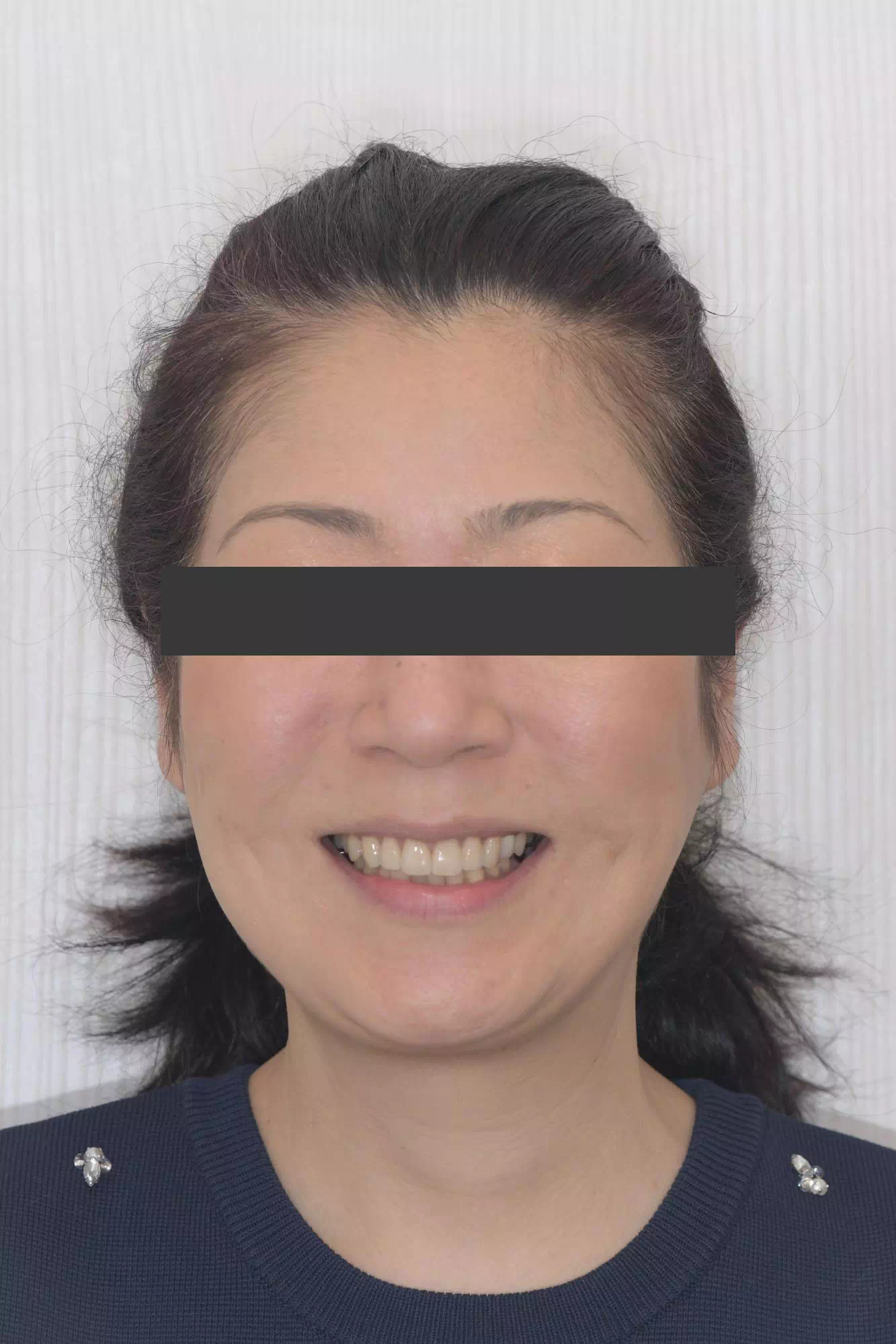 術後の画像