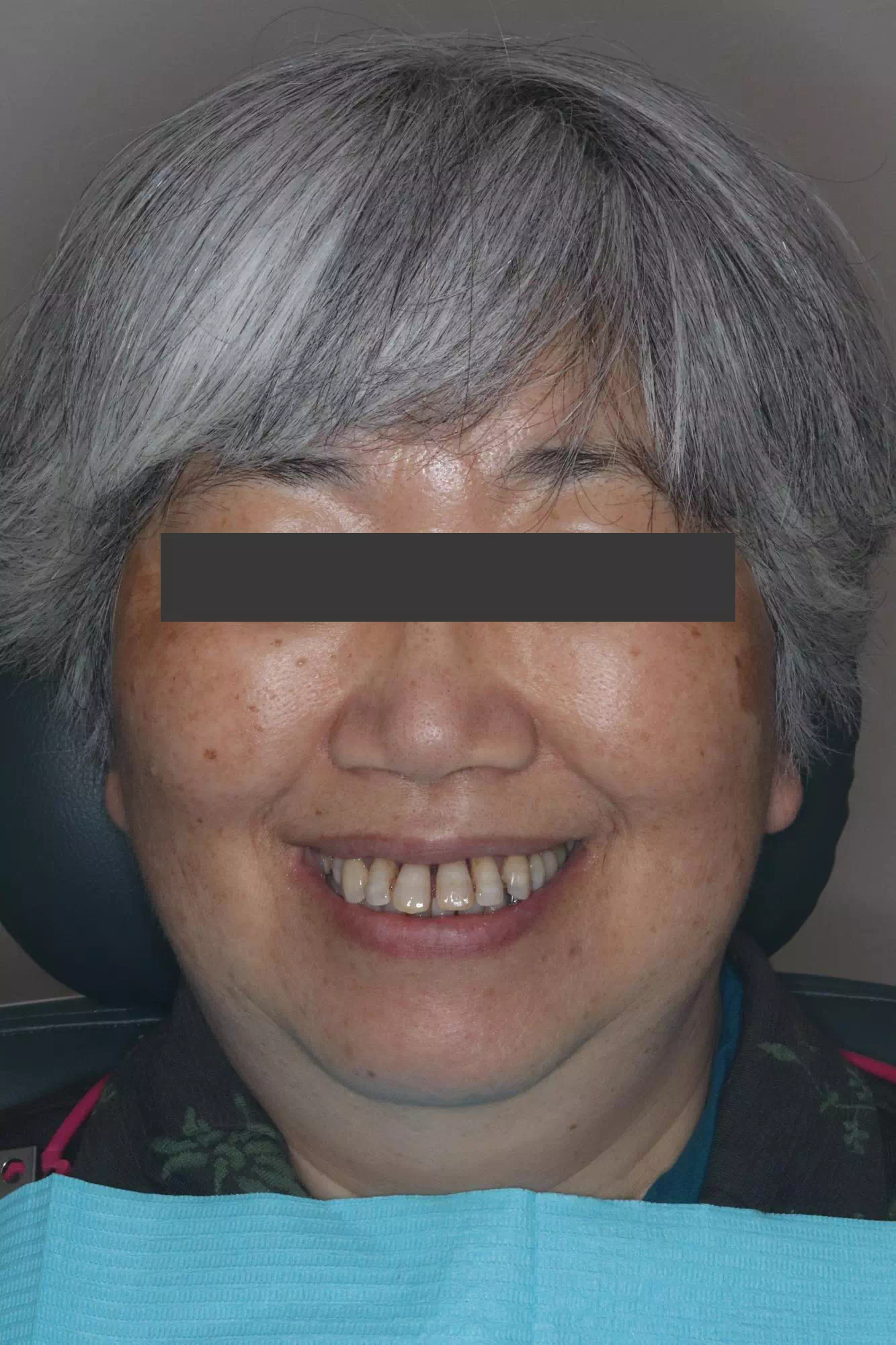 術前の画像