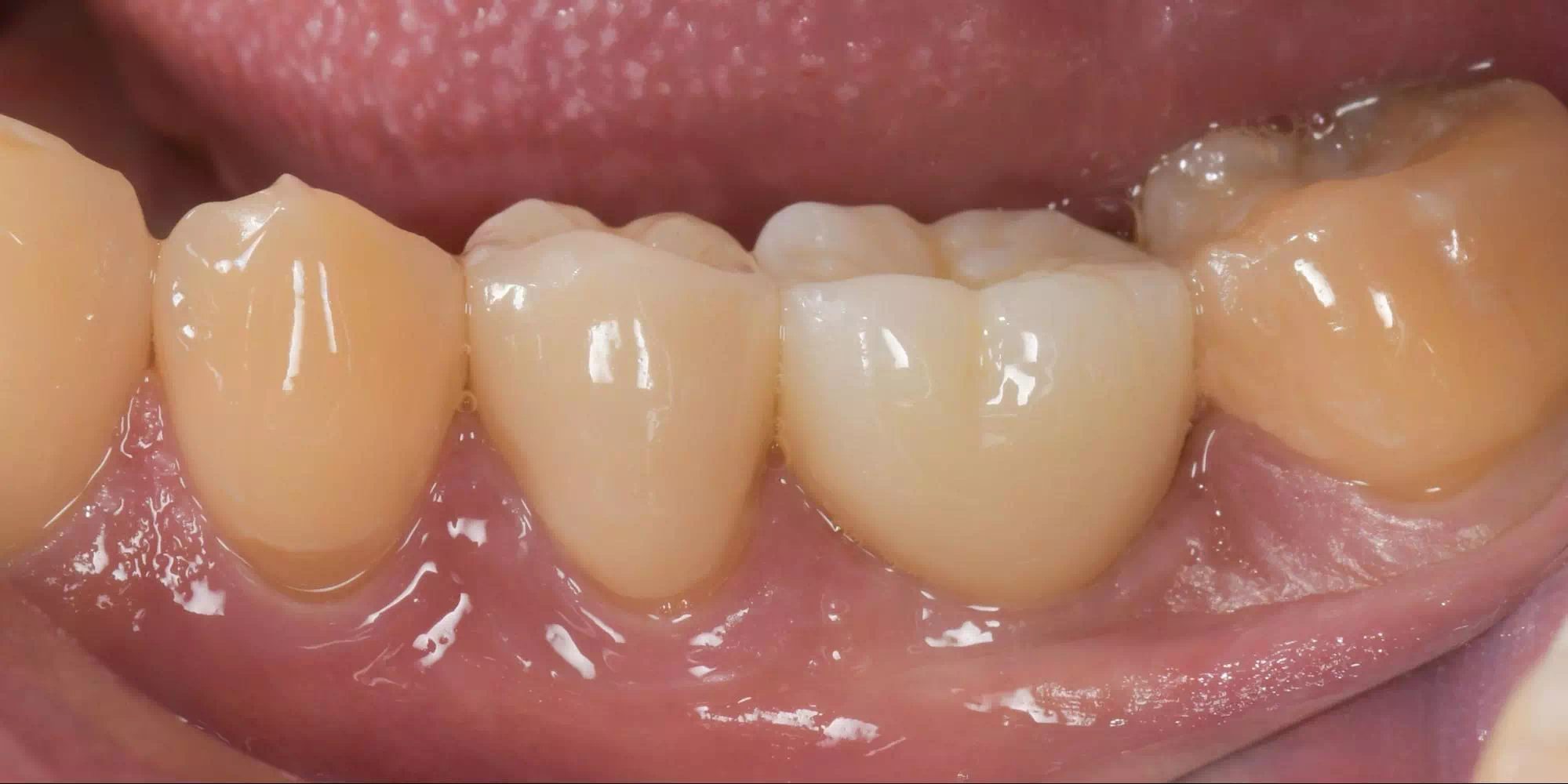 記事のイメージ画像