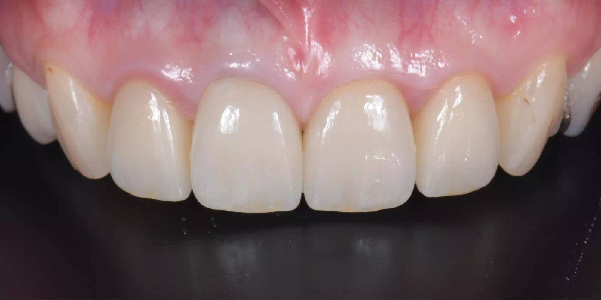 記事のイメージ画像