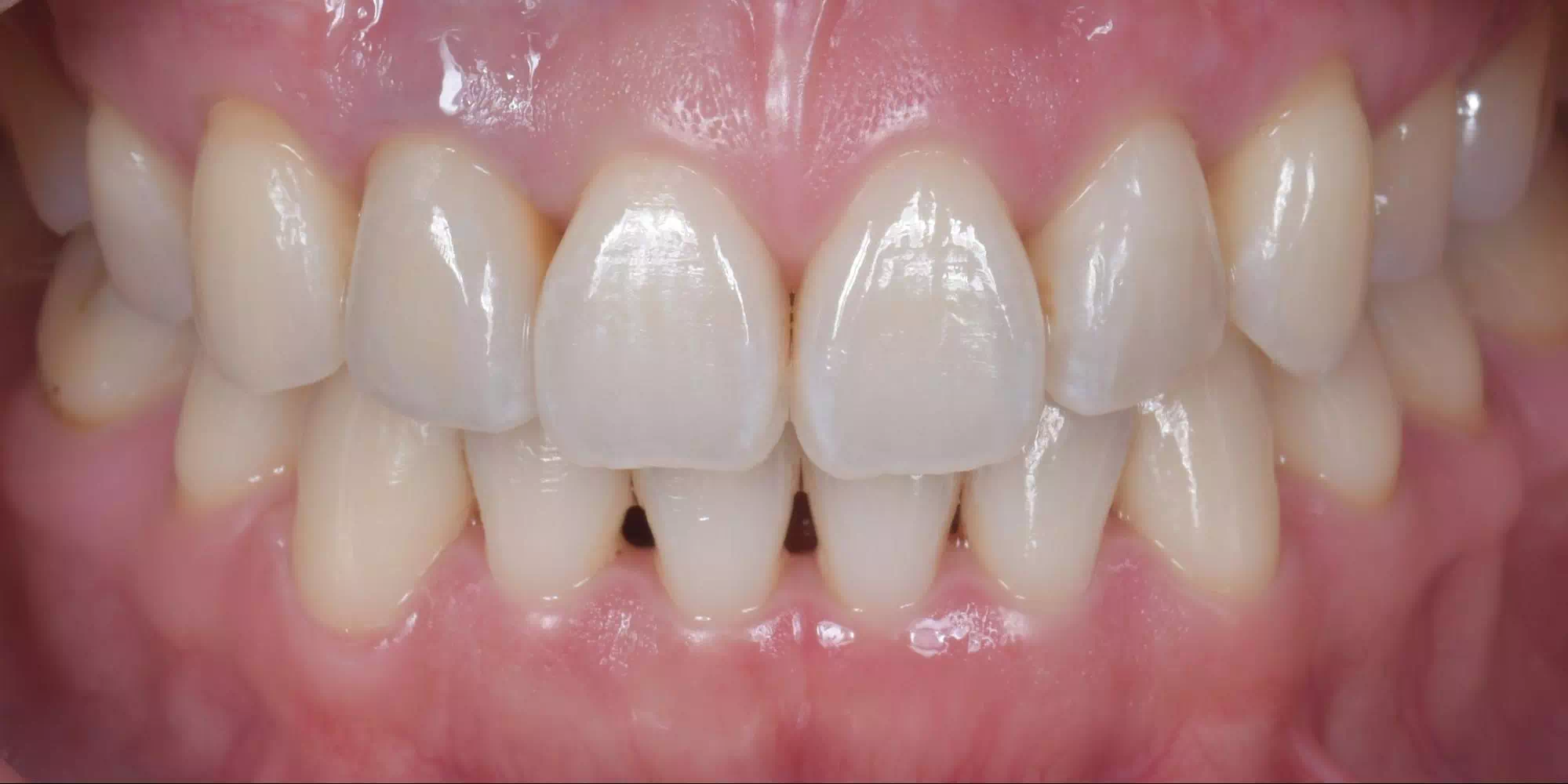 記事のイメージ画像