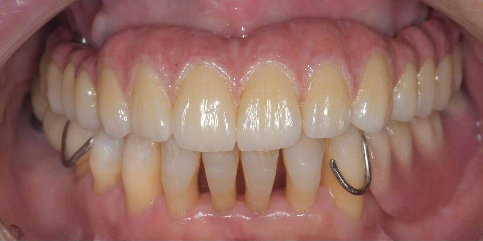 記事のイメージ画像