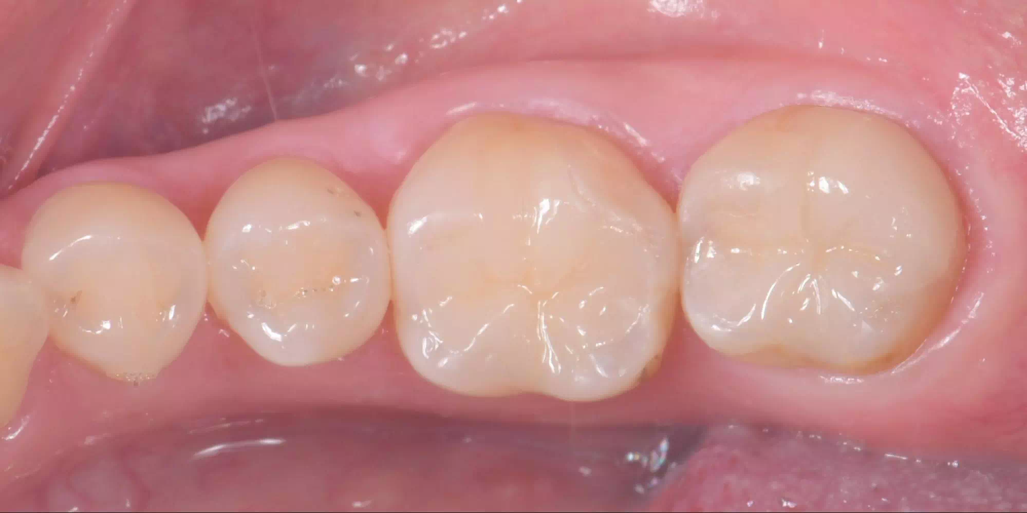 記事のイメージ画像