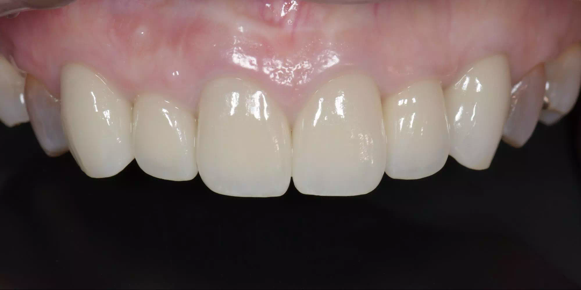 記事のイメージ画像