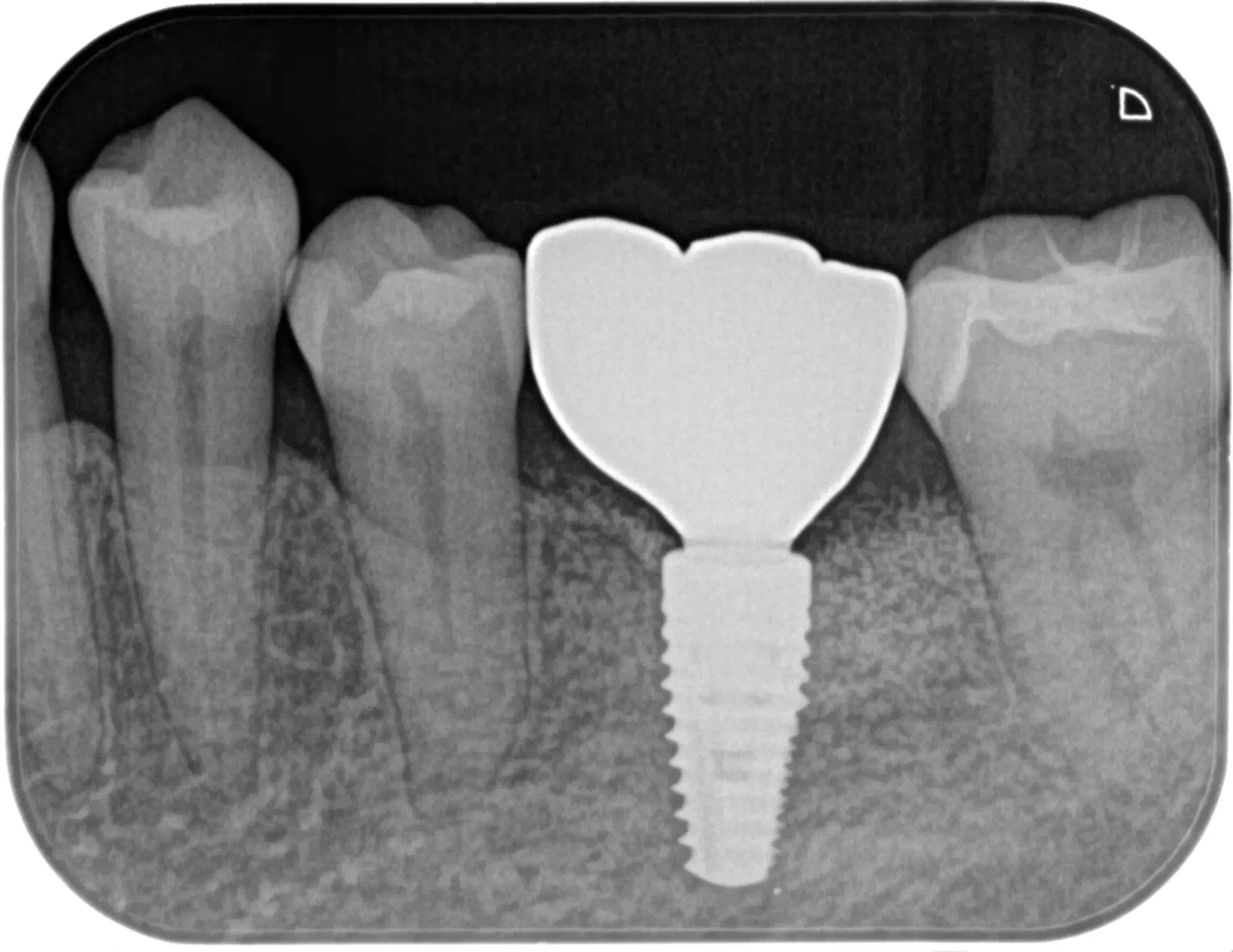 記事のイメージ画像