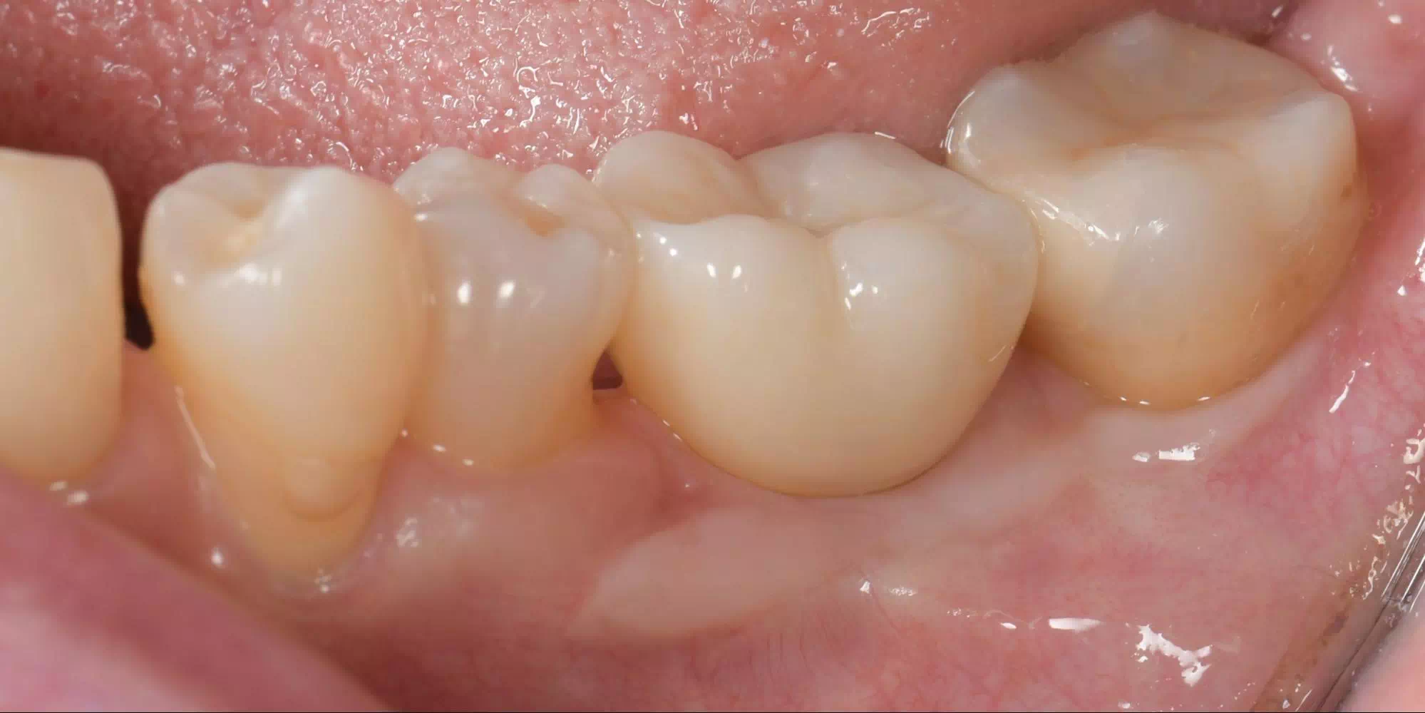 記事のイメージ画像