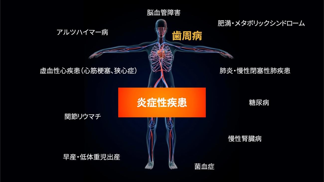 記事のイメージ画像