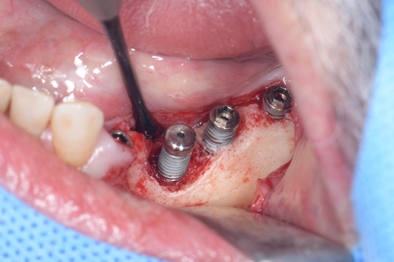 記事のイメージ画像