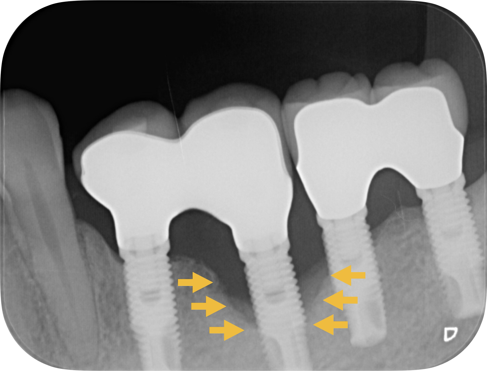 記事のイメージ画像