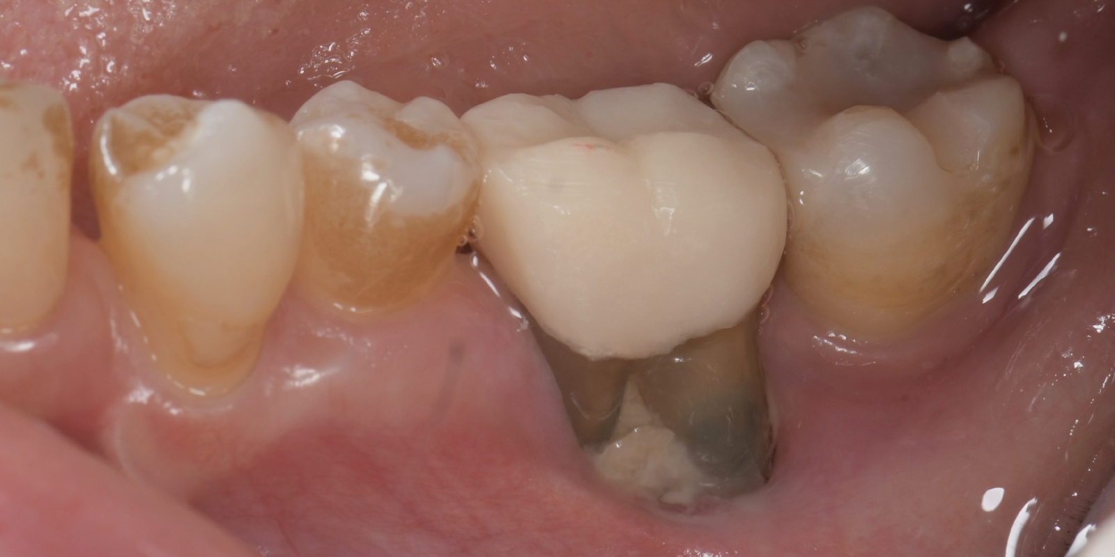 記事のイメージ画像